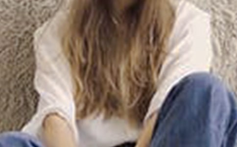 女生皮肤过敏该怎么办