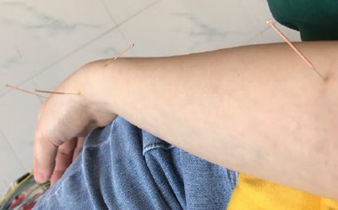 实验针灸心得体会范本优秀